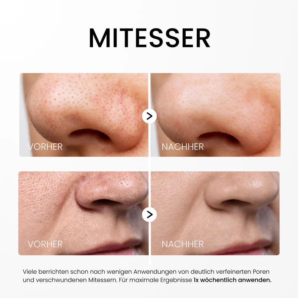 Rice Peel Glow-Serum