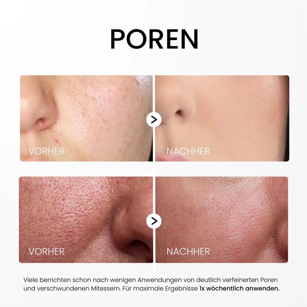 Rice Peel Glow-Serum